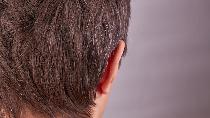 Genç yaşta saçları beyazlatan 6 neden Önlemek mümkünmüş, sırrı burada saklı