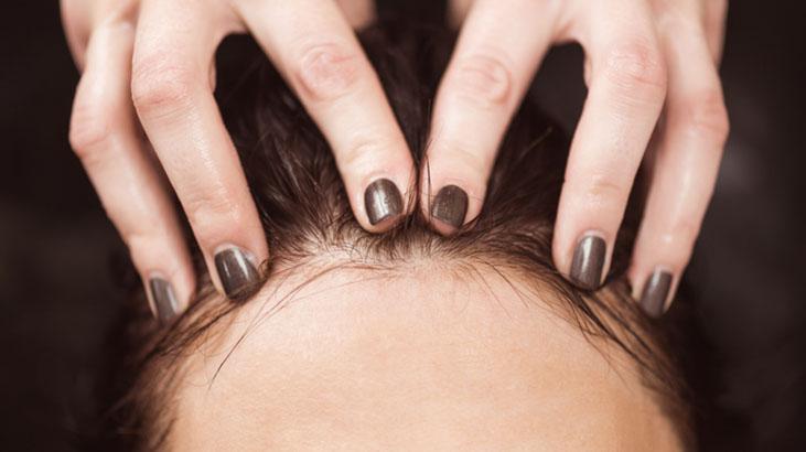 Yüzde 100 etkili sonuç Saç dökülmesine ilaç gibi gelen yöntem, soğan bile yetiyor Yüzde 100 etkili sonuç Saç dökülmesine ilaç gibi gelen yöntem, soğan bile yetiyor