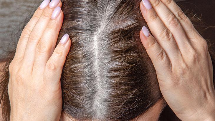 Beyazlayan saçı eski rengine döndürüyor İşin sırrı bu besinlerde saklı
