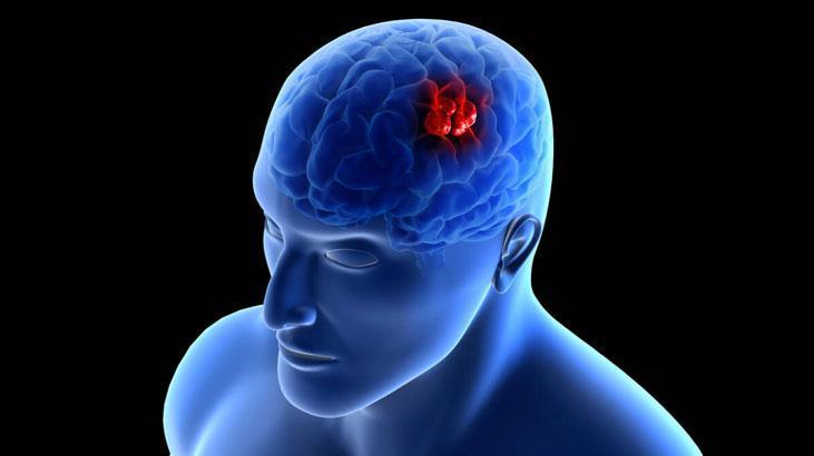 Ölümcül tümöre erkenden teşhis Yeni çıkan kan testi her şeyi değiştirebilir