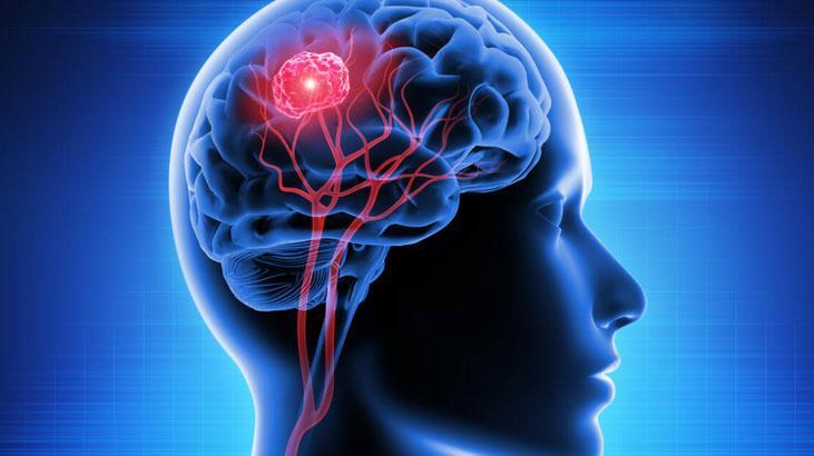 Ölümcül tümöre erkenden teşhis Yeni çıkan kan testi her şeyi değiştirebilir