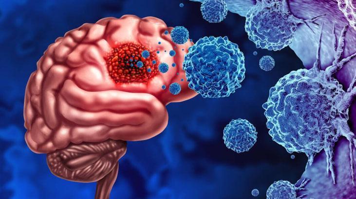 Ölümcül tümöre erkenden teşhis Yeni çıkan kan testi her şeyi değiştirebilir