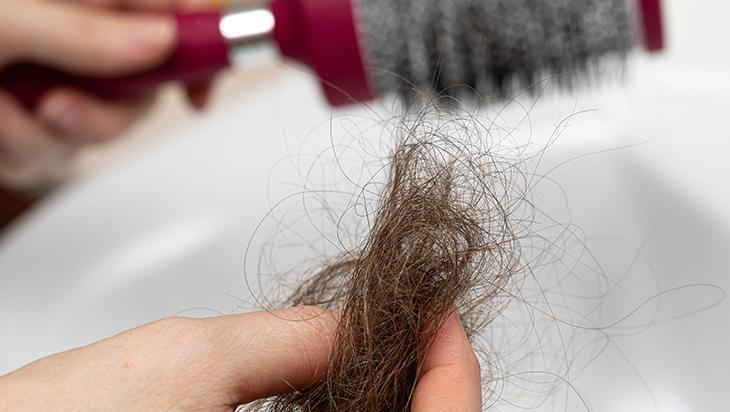 Öbek öbek dökülen saçlara kökten uca çözüm Sarımsakla gücünü katlıyor