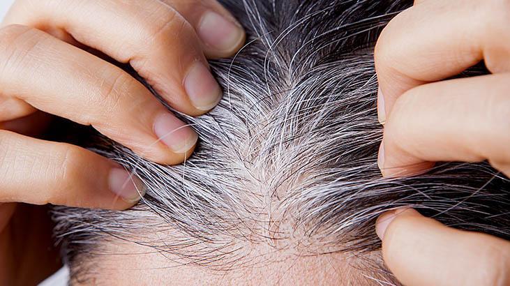 Saçları yıpratabilir