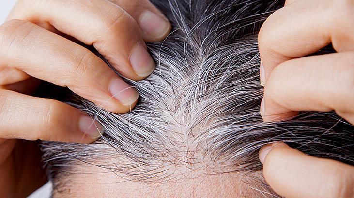 İbn-i Sinanın önerdiği 3 doğal yağ Beyazlamayı önlüyor, kepekten eser bırakmıyor