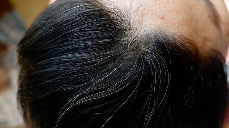 İbn-i Sinanın önerdiği 3 doğal yağ Beyazlamayı önlüyor, kepekten eser bırakmıyor