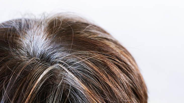 İbn-i Sinanın önerdiği 3 doğal yağ Beyazlamayı önlüyor, kepekten eser bırakmıyor