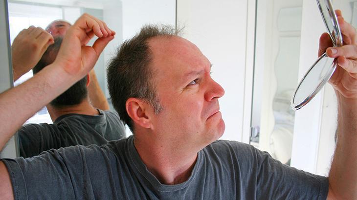 ERKEN YAŞLANMA ERKEN YAŞLANMA