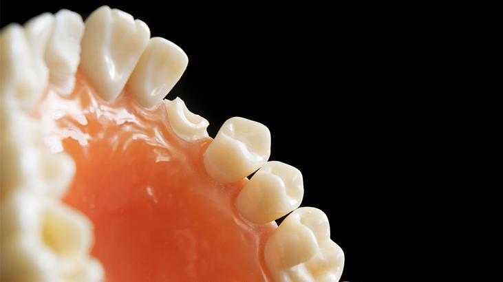 Dişleri kapkara yapıyor, patır patır döküyor Sebebi çay değil, kahve değil mor meyveler Dişleri kapkara yapıyor, patır patır döküyor Sebebi çay değil, kahve değil mor meyveler