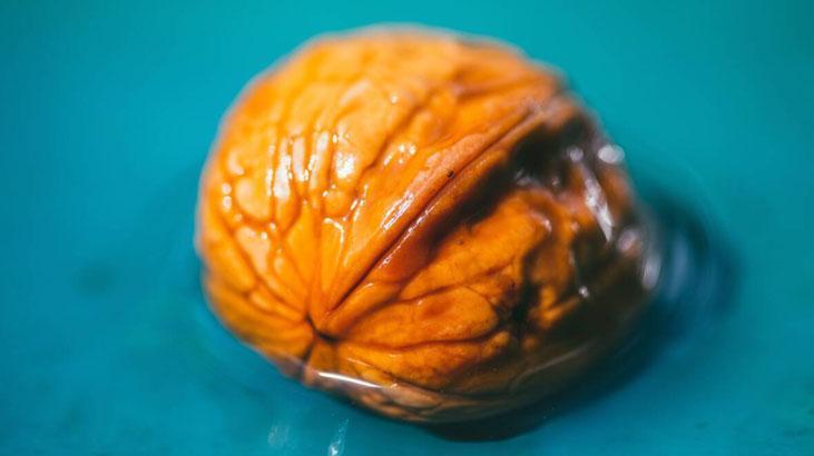 Ayaktaki nasır derdine elveda Kırdıktan sonra kabuğunu atmayın, yumuşacık yapıyor