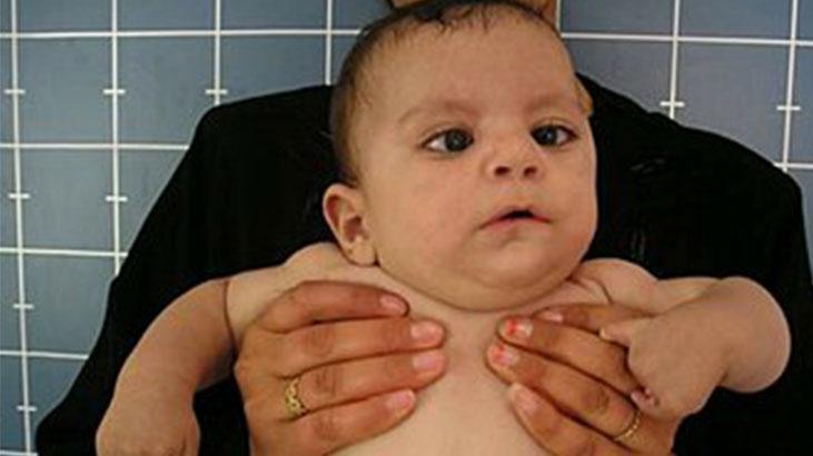 Yüzü gülmüyor, kaşları oynamıyor, tepki veremiyor Çocuğunuzun hareketlerini takip edin