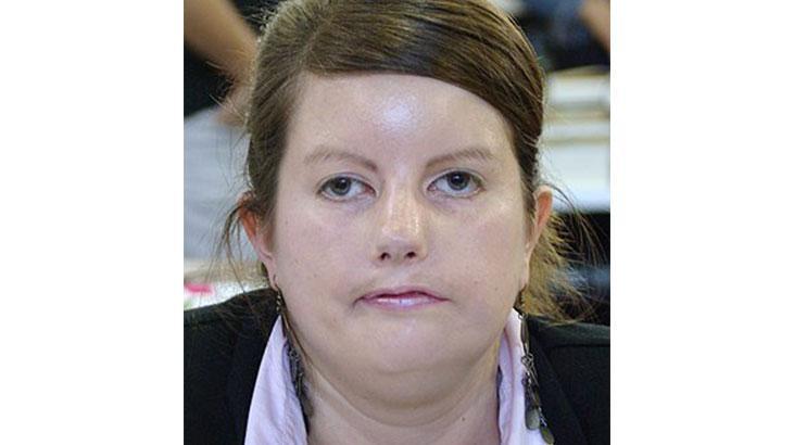 Yüzü gülmüyor, kaşları oynamıyor, tepki veremiyor Çocuğunuzun hareketlerini takip edin