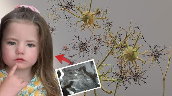 Yüzü gülmüyor, kaşları oynamıyor, tepki veremiyor Çocuğunuzun hareketlerini takip edin