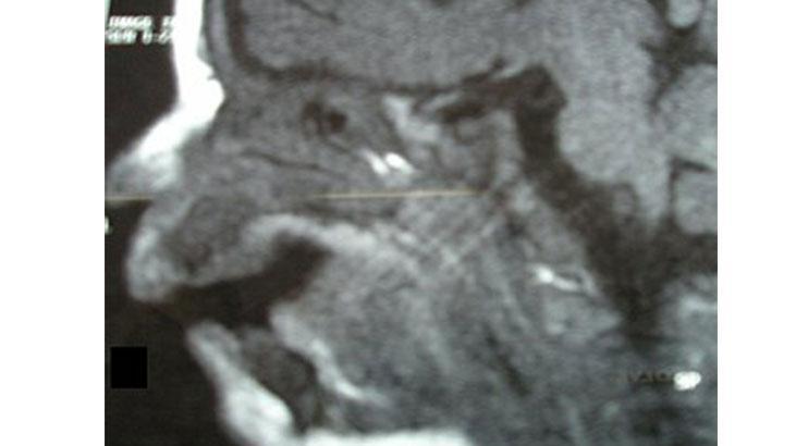 Yüzü gülmüyor, kaşları oynamıyor, tepki veremiyor Çocuğunuzun hareketlerini takip edin