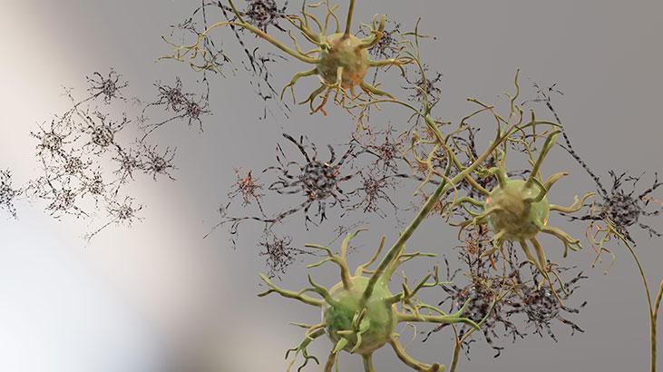 Yüzü gülmüyor, kaşları oynamıyor, tepki veremiyor Çocuğunuzun hareketlerini takip edin