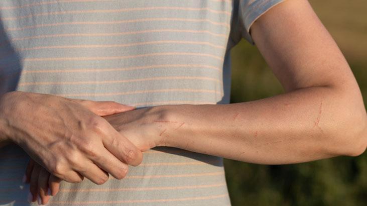 A vitamini eksikliği belirtileri nelerdir A vitamini eksikliği belirtileri nelerdir