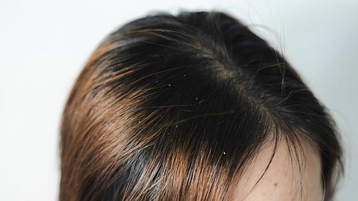 Zeytinyağı saça gerçekten iyi geliyor mu Dikkat edilmesi gereken 2 şey var