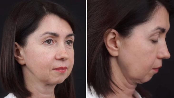 Gören 20 yaşında sanıyor, gerçek yaşı 50 1,5 ayda inanılmaz değişim, işte sırrı