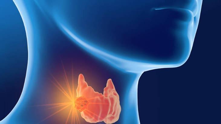 Önemli etkilere sahip Önemli etkilere sahip