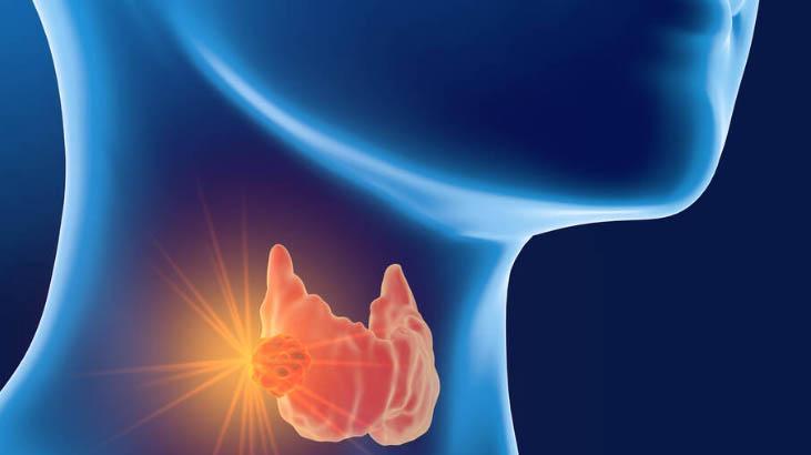 En iyi tedavisi cerrahidir En iyi tedavisi cerrahidir