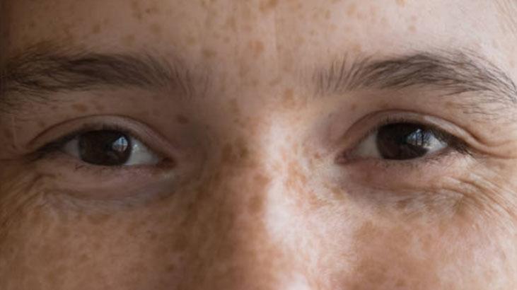 Güneş lekelerini yok eden doğal ilaç Evinizde yetiştirin, şifası içindeki jelde saklı Güneş lekelerini yok eden doğal ilaç Evinizde yetiştirin, şifası içindeki jelde saklı