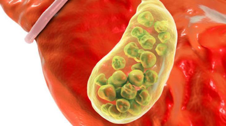 Safra temizliği yaparken dikkat