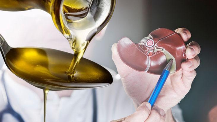 Safra taşlarına savaş açan zeytinyağı mucizesi Eriterek kırıyor, tek tek temizliyor