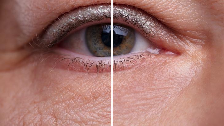 “GÖZ ÇEVRESİNDEKİ KIRIŞIKLIKLARIN OLUŞUMUNU ENGELLER”