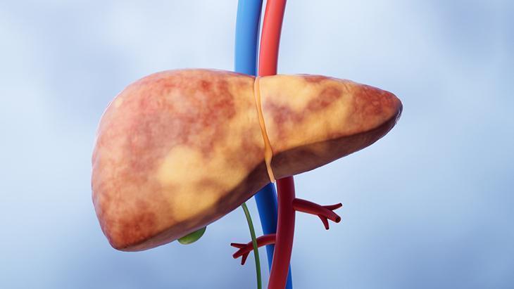 ÇAPRAZ NAKİL İLE 2 HASTAYA EŞZAMANLI NAKİL YAPILIYOR