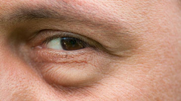 Yaşlandıkça çöken göz altlarını 10 yaş gençleştiriyor Tuza veda, retinole merhaba