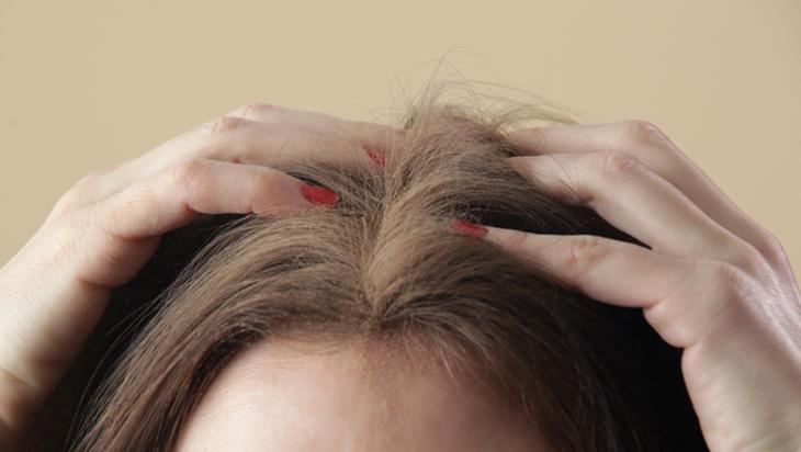 Gri saçları siyaha çeviren asırlık formül Sadece 2 malzemeyle çaresi var Gri saçları siyaha çeviren asırlık formül Sadece 2 malzemeyle çaresi var