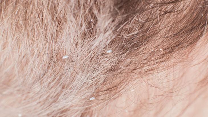 Gri saçları siyaha çeviren asırlık formül Sadece 2 malzemeyle çaresi var Gri saçları siyaha çeviren asırlık formül Sadece 2 malzemeyle çaresi var