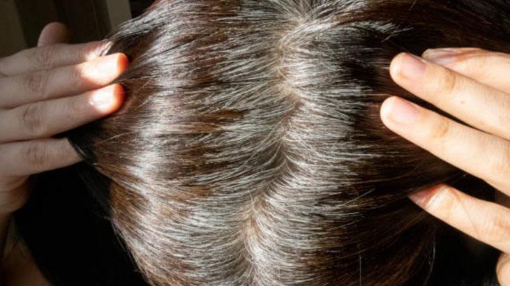 Beyaz saçlar koparınca çoğalır mı Yıllardır bu efsaneyle yaşıyoruz, cevabı şaşırttı