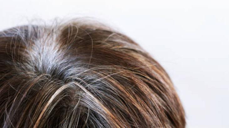 Beyaz saçlar koparınca çoğalır mı Yıllardır bu efsaneyle yaşıyoruz, cevabı şaşırttı