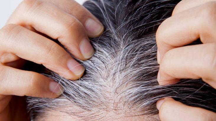 Beyaz saçlar koparınca çoğalır mı Yıllardır bu efsaneyle yaşıyoruz, cevabı şaşırttı