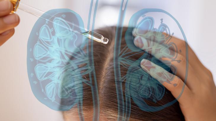 Saça kullanılıyor ama herkese uygun değil Kıvırcıklar düzleşiyor