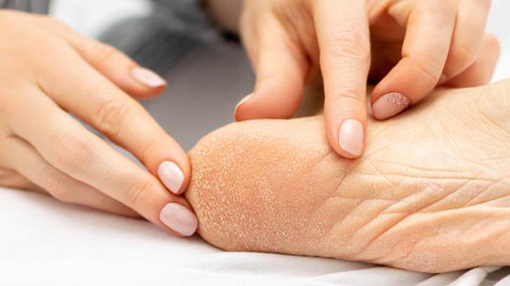 6. Zeytinyağı ve Şeker Peelingi