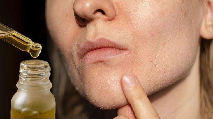 Cilde, saça buğdaydan gelen güzellik Kimse bilmiyor, E vitaminine doyuracak