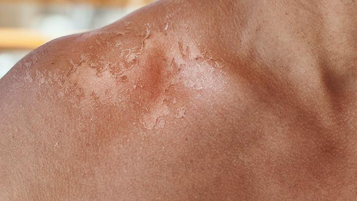 Güneş kremini yanlış kullanıyor olabilirsiniz 13 dakika kuralına dikkat