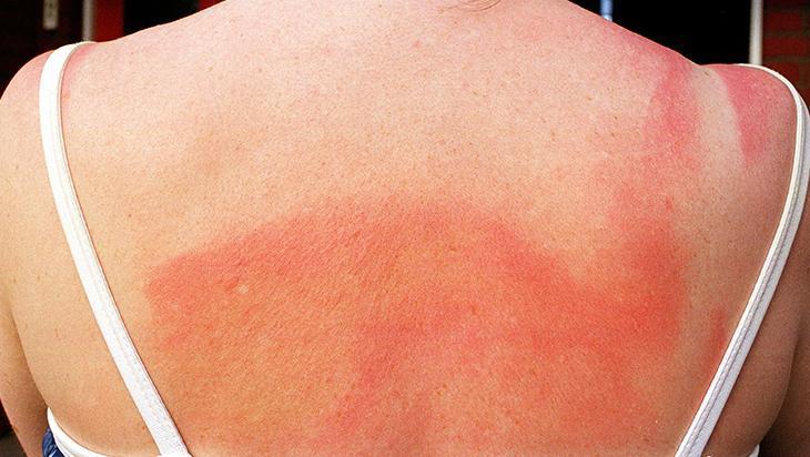 Güneş kremini yanlış kullanıyor olabilirsiniz 13 dakika kuralına dikkat