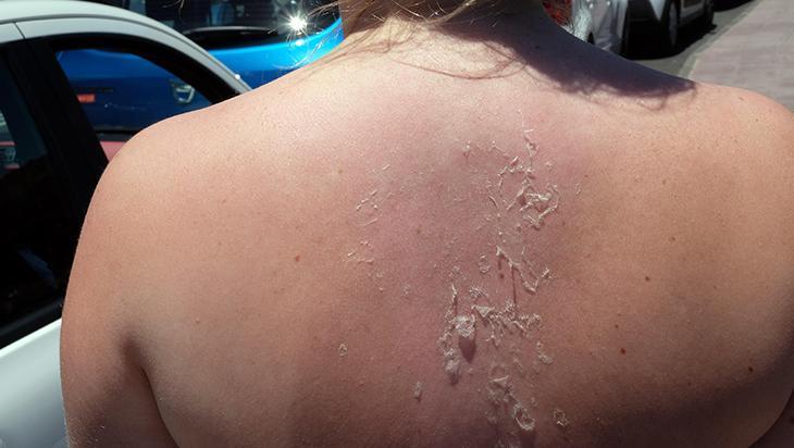 Güneş kremi seçerken bunlara dikkat edin Birçok kişi yanlış biliniyor, miktarı çok önemli Güneş kremi seçerken bunlara dikkat edin Birçok kişi yanlış biliniyor, miktarı çok önemli