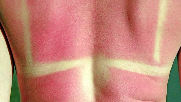 Güneş kremi seçerken bunlara dikkat edin Birçok kişi yanlış biliniyor, miktarı çok önemli Güneş kremi seçerken bunlara dikkat edin Birçok kişi yanlış biliniyor, miktarı çok önemli