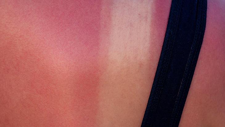 Güneş kremi seçerken bunlara dikkat edin Birçok kişi yanlış biliniyor, miktarı çok önemli Güneş kremi seçerken bunlara dikkat edin Birçok kişi yanlış biliniyor, miktarı çok önemli