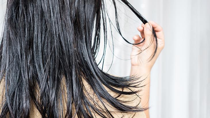 Saçlara en iyisi ama yüze bulaşırsa felaket Meğer sivilceleri besliyormuş Saçlara en iyisi ama yüze bulaşırsa felaket Meğer sivilceleri besliyormuş