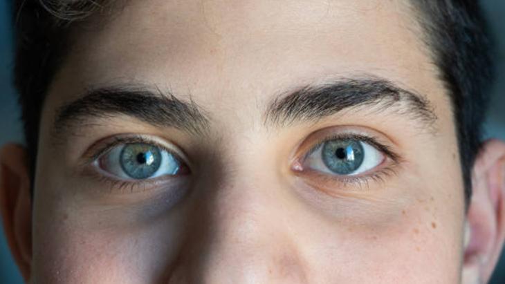 NADİREN GÖRÜLEN GÖZ RENKLERİ