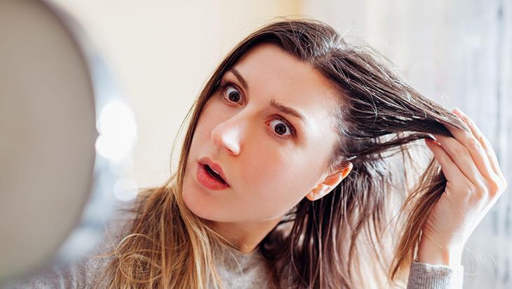 Yağlı saçı 5 dakikada kurtaran yöntem Evde bulundurun, belli bile olmayacak