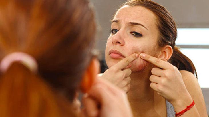 Çekirdek yedikten sonra sivilceyi önlemek için ne yapılmalıdır