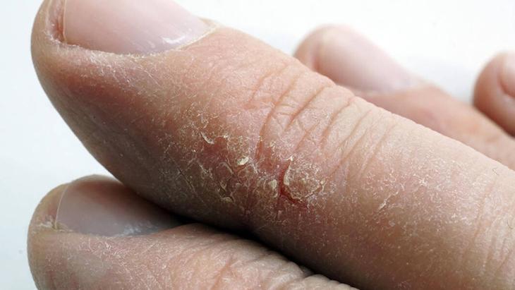 3- Cilt bariyerinizi koruyun