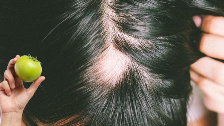 Kelliğe tek çare: Domates kabuğu Kilit nokta rengiymiş, köklerden saç fışkıracak