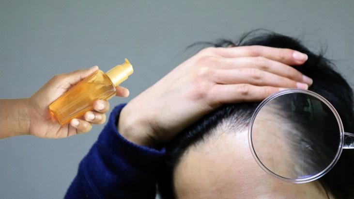 Saç dökülmesine kökten uca çözüm 2 damlası mucizeler yaratıyor Saç dökülmesine kökten uca çözüm 2 damlası mucizeler yaratıyor